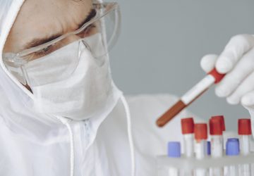 Ini Biaya Tes Swab Jakarta dan Sekitarnya!
