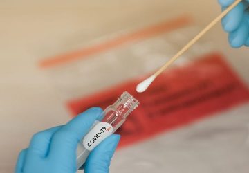 Harga Swab PCR Covid-19 di Klinik dr. Mahdian, Terjangkau!