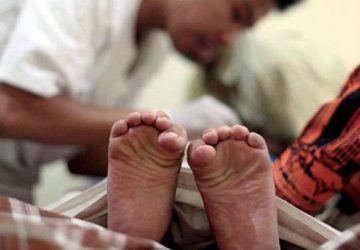 Apakah Sunat Itu Sakit? Ini Jawabannya!
