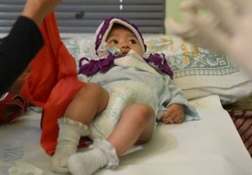 Sunat Bayi Perempuan Umur Berapa, Cek Di sini!