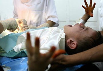Pentingnya Peran Orangtua dan Dokter Sunat dalam Menangani Anak Berkebutuhan Khusus